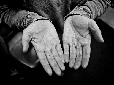 Sztuczna inteligencja wykrywa tę chorobę z dużą dokładnością